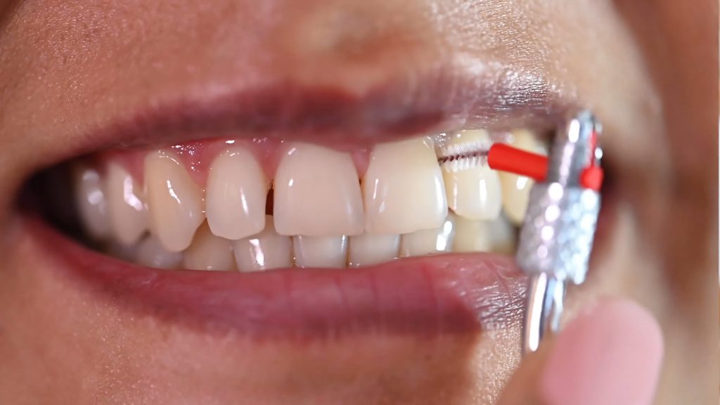 Achieving Oral Health and Wellbeing