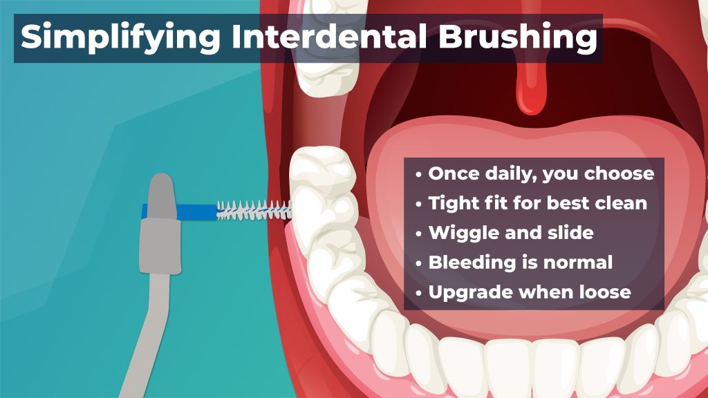 Tips & Tricks for Interdental Brushing